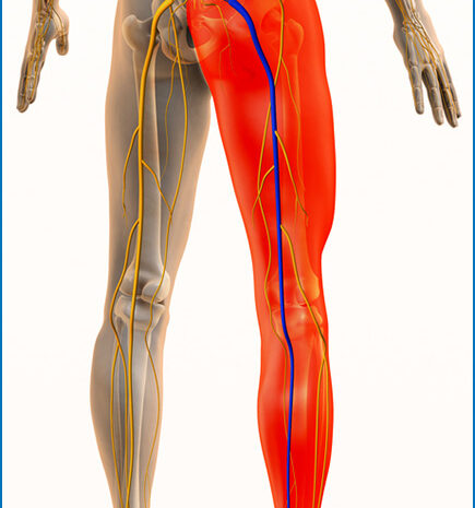  Find Lasting Relief with a Sciatica Chiropractor in Shreveport